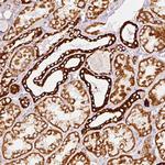 MT-CO2 Antibody in Immunohistochemistry (Paraffin) (IHC (P))