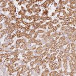 MT-CO2 Antibody in Immunohistochemistry (Paraffin) (IHC (P))