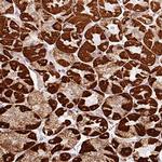 MT-CO2 Antibody in Immunohistochemistry (Paraffin) (IHC (P))