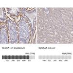 SGLT1 Antibody