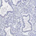 SGLT1 Antibody in Immunohistochemistry (Paraffin) (IHC (P))