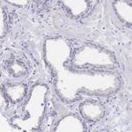 SGLT1 Antibody in Immunohistochemistry (Paraffin) (IHC (P))