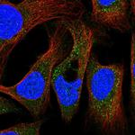 PEX19 Antibody in Immunocytochemistry (ICC/IF)