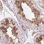 C/EBP zeta Antibody in Immunohistochemistry (Paraffin) (IHC (P))