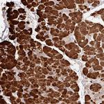 Carboxypeptidase A1 Antibody in Immunohistochemistry (Paraffin) (IHC (P))