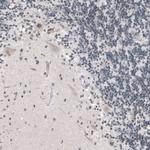 SUV420H2 Antibody in Immunohistochemistry (Paraffin) (IHC (P))