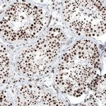 SUV420H2 Antibody in Immunohistochemistry (Paraffin) (IHC (P))