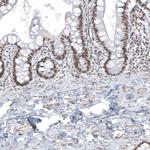 SUV420H2 Antibody in Immunohistochemistry (Paraffin) (IHC (P))