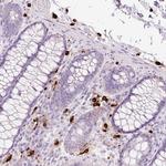 Mast Cell Chymase Antibody in Immunohistochemistry (Paraffin) (IHC (P))