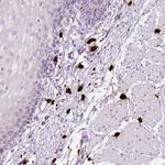 Mast Cell Chymase Antibody in Immunohistochemistry (Paraffin) (IHC (P))