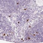 Mast Cell Chymase Antibody in Immunohistochemistry (Paraffin) (IHC (P))