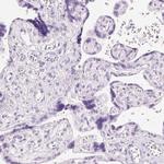 Mast Cell Chymase Antibody in Immunohistochemistry (Paraffin) (IHC (P))