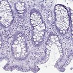 ATP4B Antibody in Immunohistochemistry (Paraffin) (IHC (P))