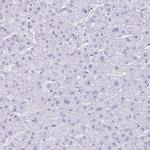 ATP4B Antibody in Immunohistochemistry (Paraffin) (IHC (P))