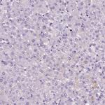 MZB1 Antibody in Immunohistochemistry (Paraffin) (IHC (P))