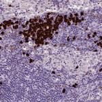 MZB1 Antibody in Immunohistochemistry (Paraffin) (IHC (P))