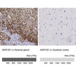 AKR1B1 Antibody