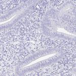 CD21 Antibody in Immunohistochemistry (Paraffin) (IHC (P))