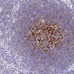 CD21 Antibody in Immunohistochemistry (Paraffin) (IHC (P))