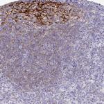 CD21 Antibody in Immunohistochemistry (Paraffin) (IHC (P))