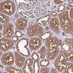 ITPKC Antibody in Immunohistochemistry (Paraffin) (IHC (P))