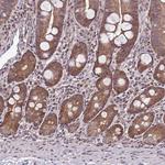 ITPKC Antibody in Immunohistochemistry (Paraffin) (IHC (P))