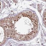 ITPKC Antibody in Immunohistochemistry (Paraffin) (IHC (P))