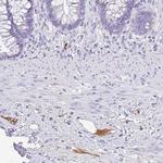 Complement Factor H Antibody in Immunohistochemistry (Paraffin) (IHC (P))