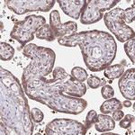 HFE Antibody in Immunohistochemistry (Paraffin) (IHC (P))