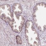 HFE Antibody in Immunohistochemistry (Paraffin) (IHC (P))