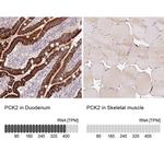 PCK2 Antibody