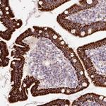 PCK2 Antibody in Immunohistochemistry (Paraffin) (IHC (P))