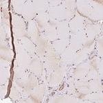 PCK2 Antibody in Immunohistochemistry (Paraffin) (IHC (P))