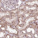 KPNA1 Antibody in Immunohistochemistry (Paraffin) (IHC (P))