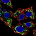 FDXR Antibody in Immunocytochemistry (ICC/IF)