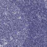 FDXR Antibody in Immunohistochemistry (Paraffin) (IHC (P))