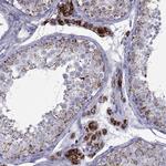 FDXR Antibody in Immunohistochemistry (Paraffin) (IHC (P))