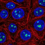 YBX2 Antibody in Immunocytochemistry (ICC/IF)