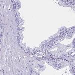 YBX2 Antibody in Immunohistochemistry (Paraffin) (IHC (P))