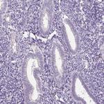 KPNA5 Antibody in Immunohistochemistry (Paraffin) (IHC (P))