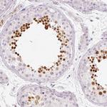 KPNA5 Antibody in Immunohistochemistry (Paraffin) (IHC (P))