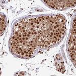 MORF4L2 Antibody in Immunohistochemistry (Paraffin) (IHC (P))