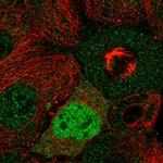 Cyclin D2 Antibody in Immunocytochemistry (ICC/IF)