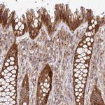 IDUA Antibody in Immunohistochemistry (Paraffin) (IHC (P))