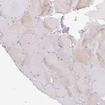 IDUA Antibody in Immunohistochemistry (Paraffin) (IHC (P))