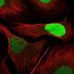 DUT Antibody in Immunocytochemistry (ICC/IF)