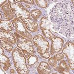 DUT Antibody in Immunohistochemistry (Paraffin) (IHC (P))