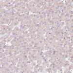 DUT Antibody in Immunohistochemistry (Paraffin) (IHC (P))