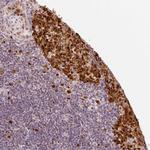 DUT Antibody in Immunohistochemistry (Paraffin) (IHC (P))