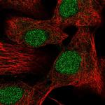 DR4 Antibody in Immunocytochemistry (ICC/IF)